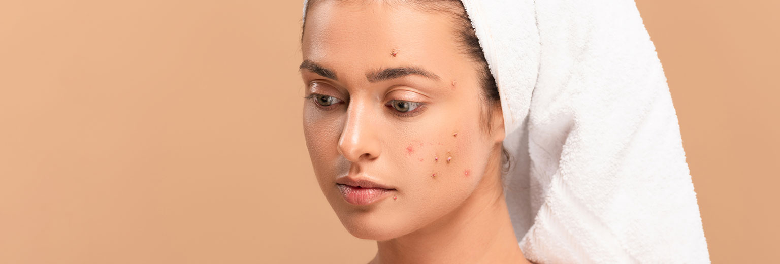 Understanding Different Types of Acne and Treatment Methods