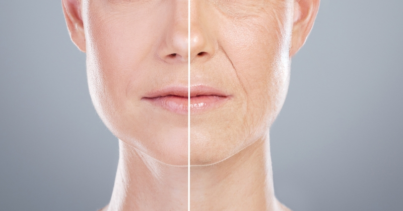 Anti Aging Treatments That Actually Improve Skin Quality